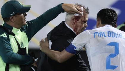 El entrenador de México, Javier Aguirre, luego de resultar herido en la cabeza al ser golpeado por un objeto lanzado desde las gradas, 15 de noviembre de 2024.