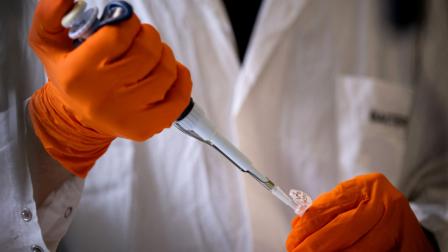 Un técnico de laboratorio prepara enzimas usadas para hacer las vacunas individualizadas contra el cáncer TG4050, en un laboratorio de la firma Transgene, en Illkirch-Graffenstaden, France, el 27 de agosto de 2025.