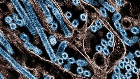 Micrografía electrónica coloreada que muestra partículas del virus de la gripe o influenza aviar, A H5N1, pintadas de azul.