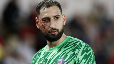 Gianluigi Donnarumma, arquero del PSG, con una lesión en su cara durante el partido ante Mónaco, el 18 de diciembre de 2024.