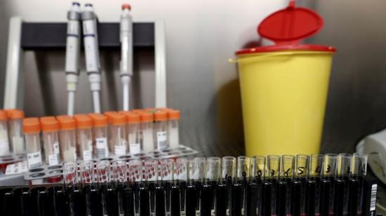 Las primeras dosis de la vacuna rusa EpiVacCorona serán suministradas a la población rusa a partir del 10 de diciembre de 2020.