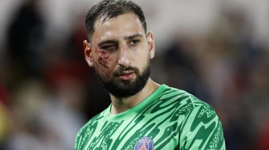 Gianluigi Donnarumma, arquero del PSG, con una lesión en su cara durante el partido ante Mónaco, el 18 de diciembre de 2024.