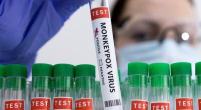Tubos de ensayo con muestras del virus viruela del mono, en Portugal, el 25 de mayo de 2022.