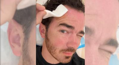 Kevin Jonas muestra en un video subido a Instagram los resultados de una operación por cáncer de piel.